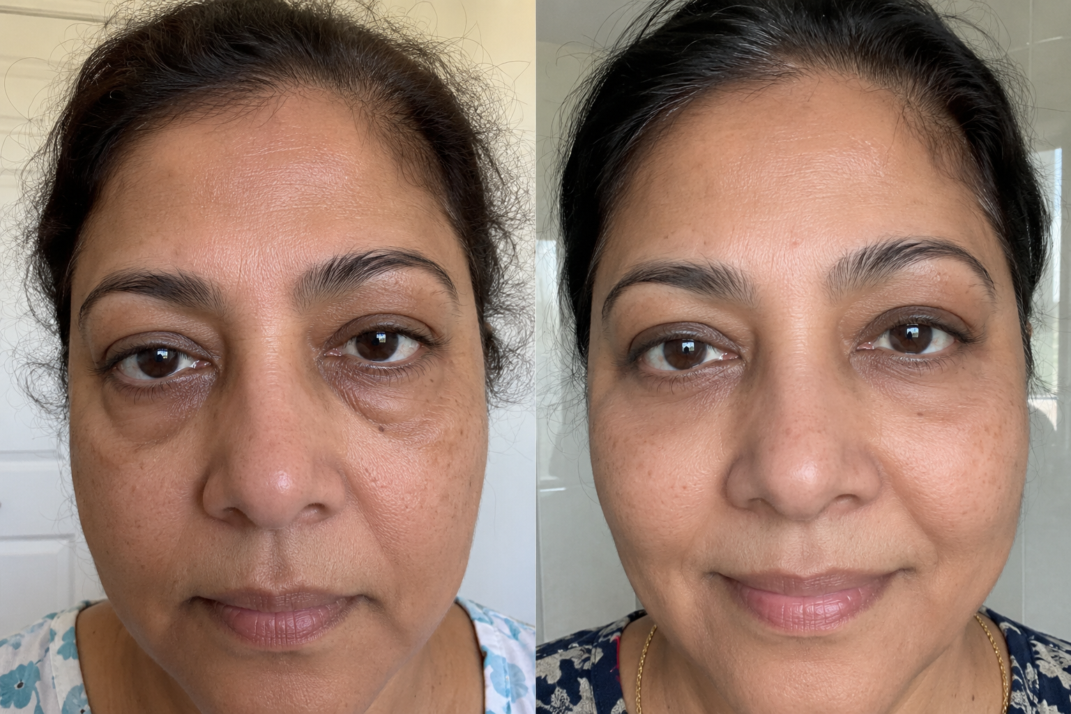 Camille L. — before and after