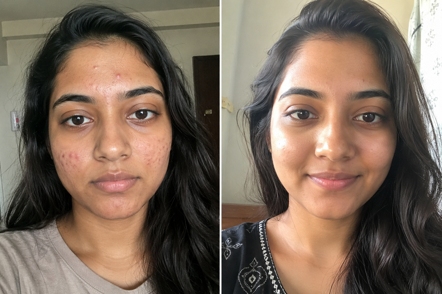 Camille D. — before and after