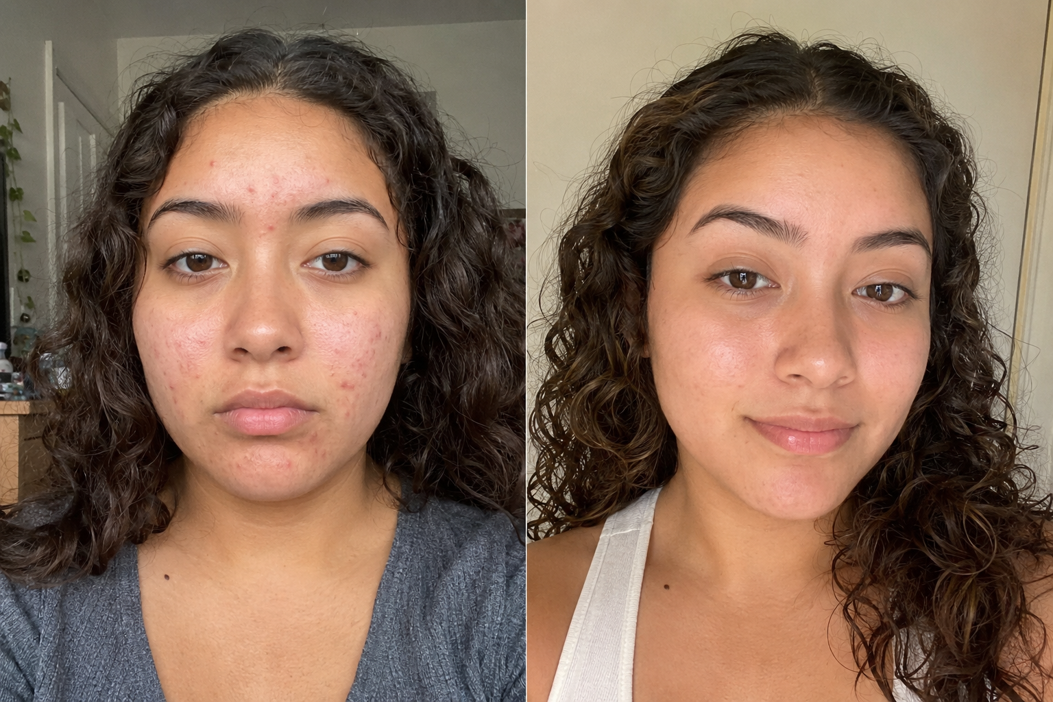 Camille D. — before and after