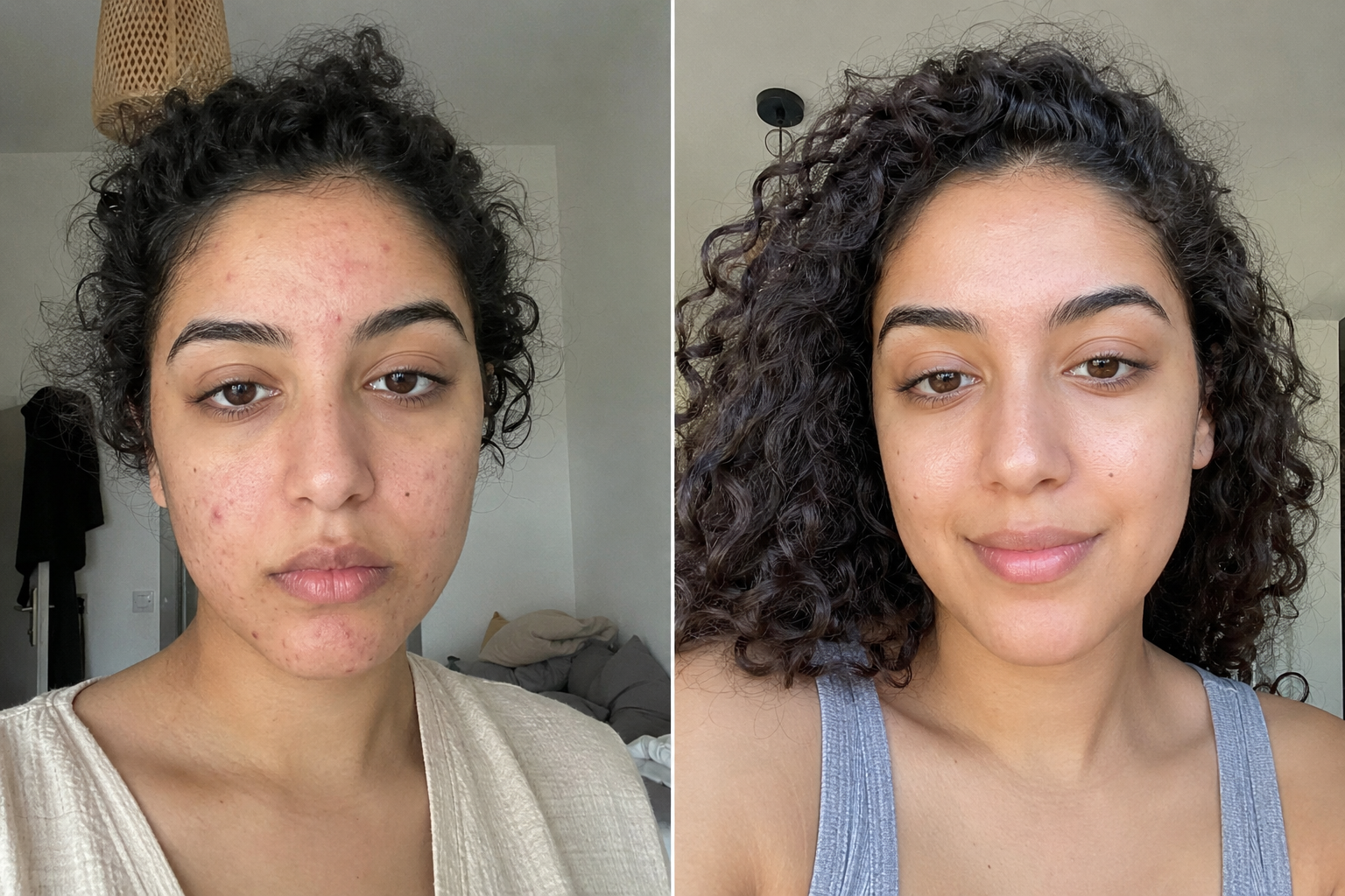 Héloïse D. — before and after