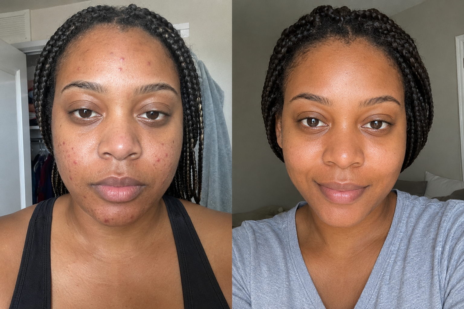 BASALT Clarifying Cream — before and after