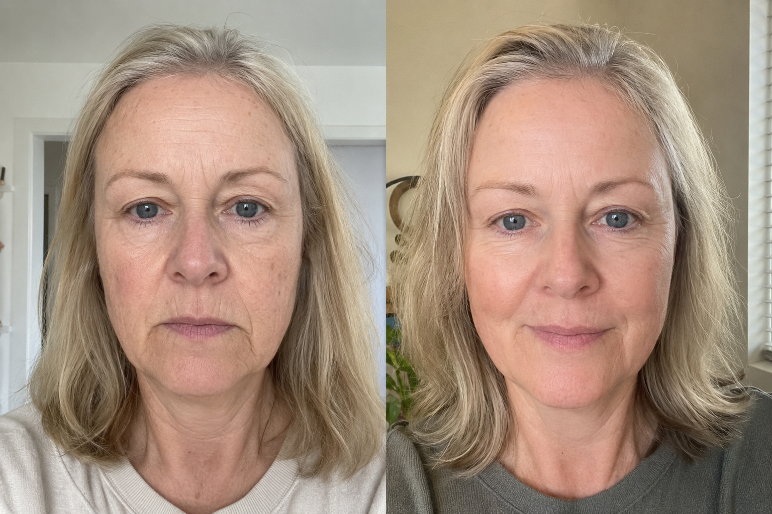 Isabelle G. — before and after