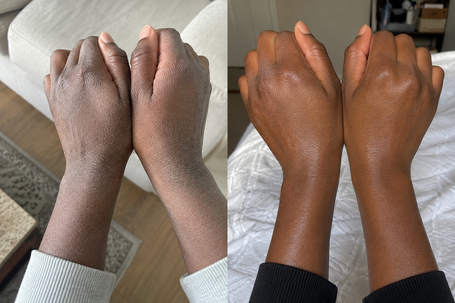Nadia B. — before and after