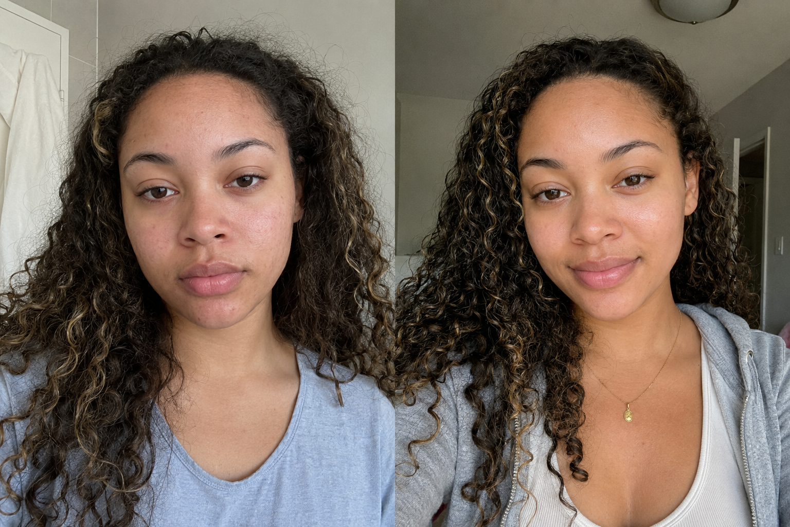 Chloé V. — before and after