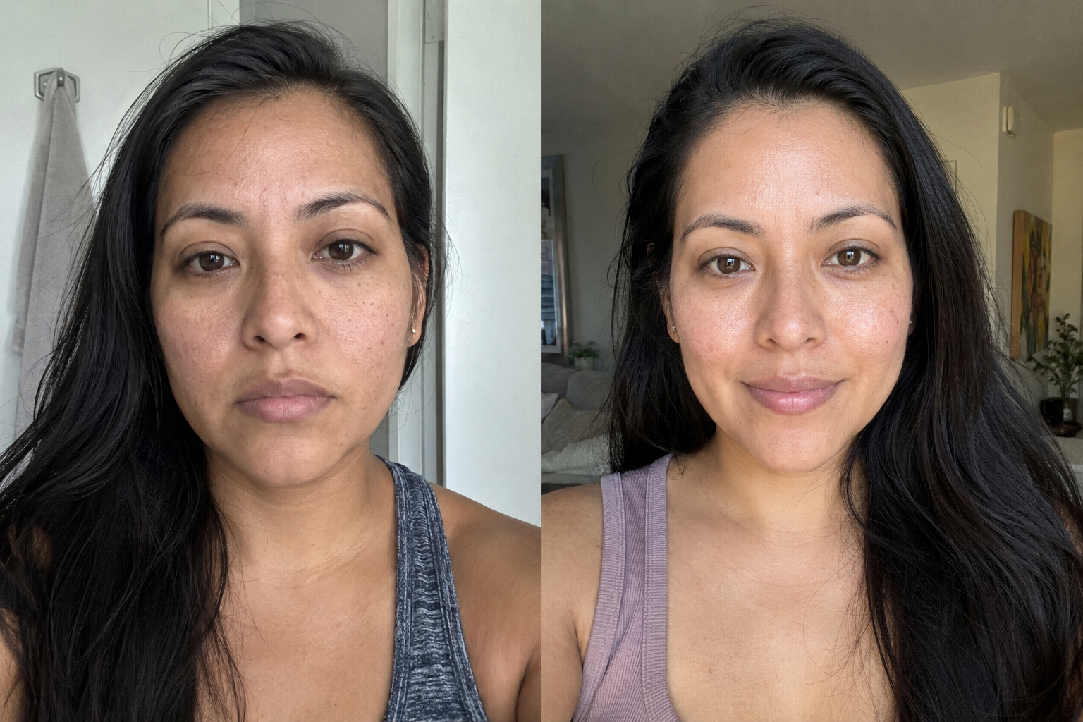Léa M. — before and after