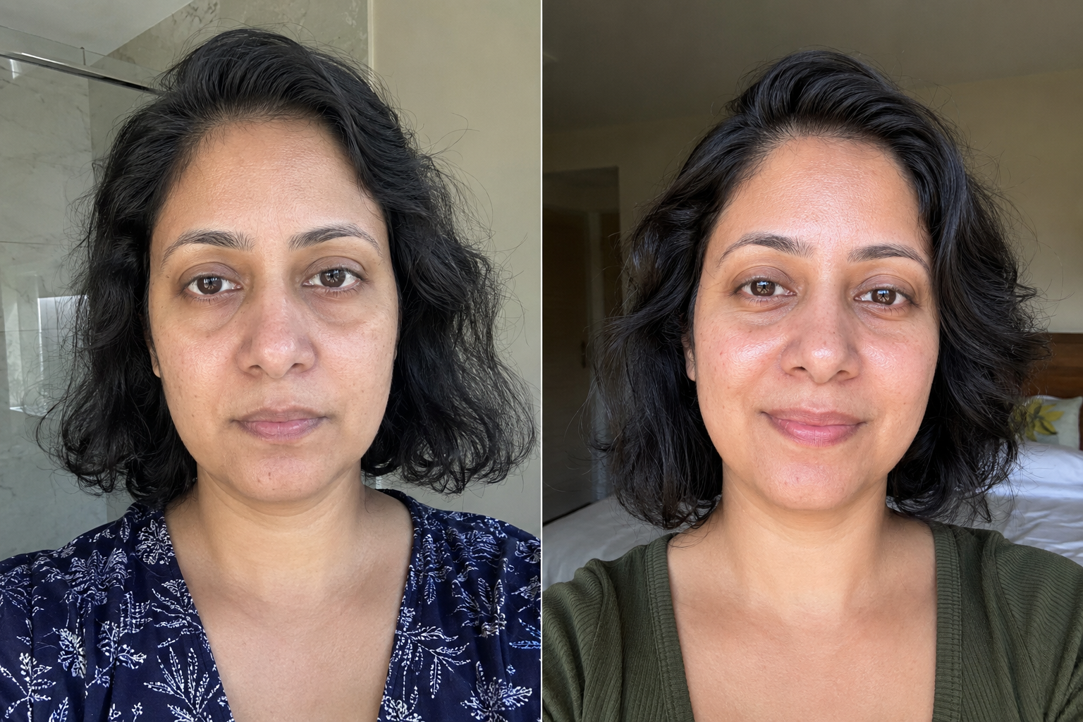 Théa M. — before and after