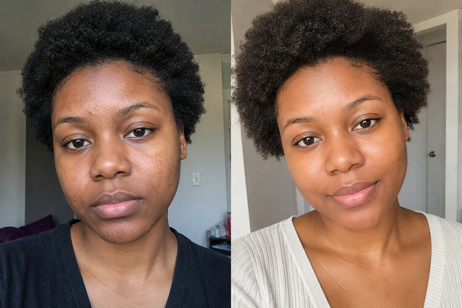 Amandine L. — before and after