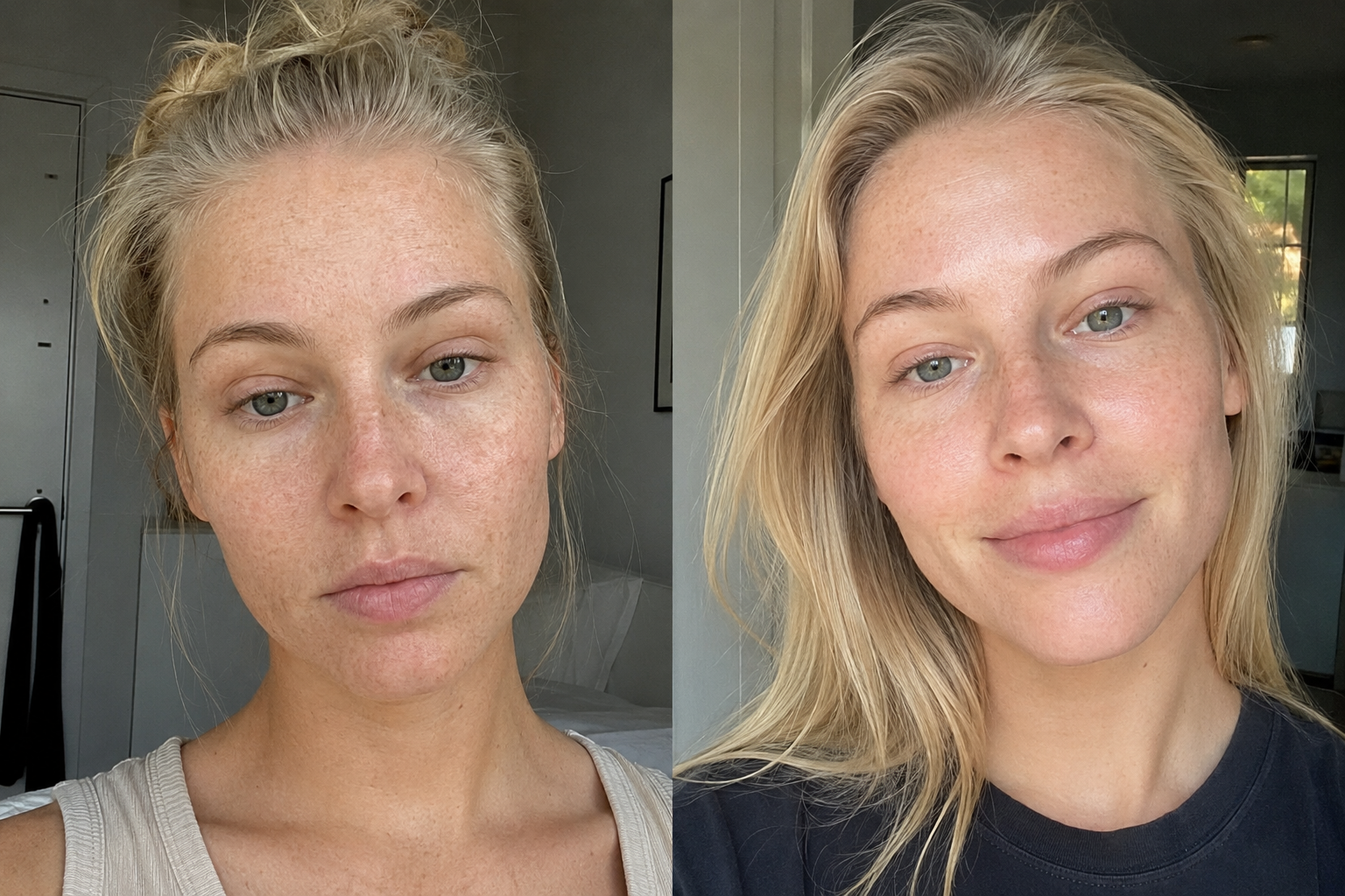 Svea H. — before and after