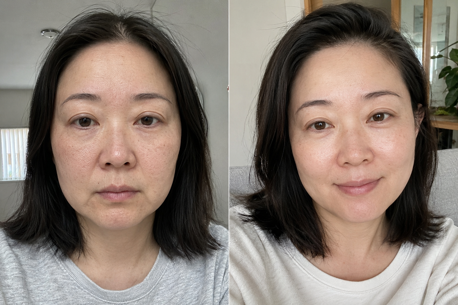 Julie P. — before and after
