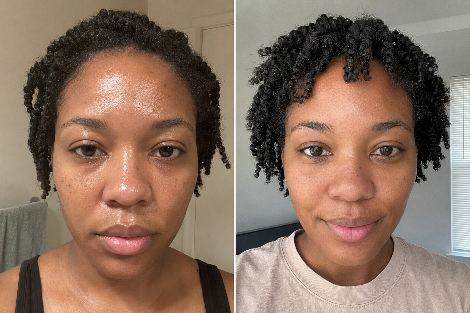 Louise P. — before and after