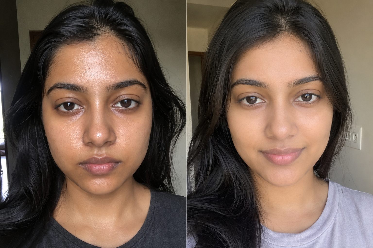 Sarah L. — before and after