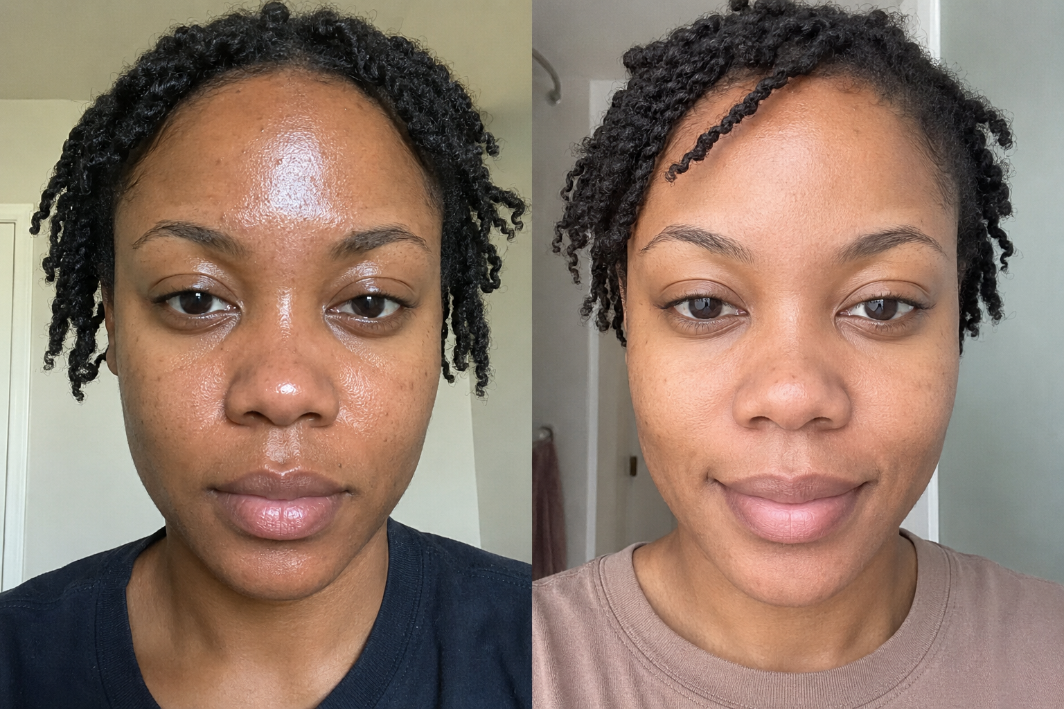 Manon R. — before and after