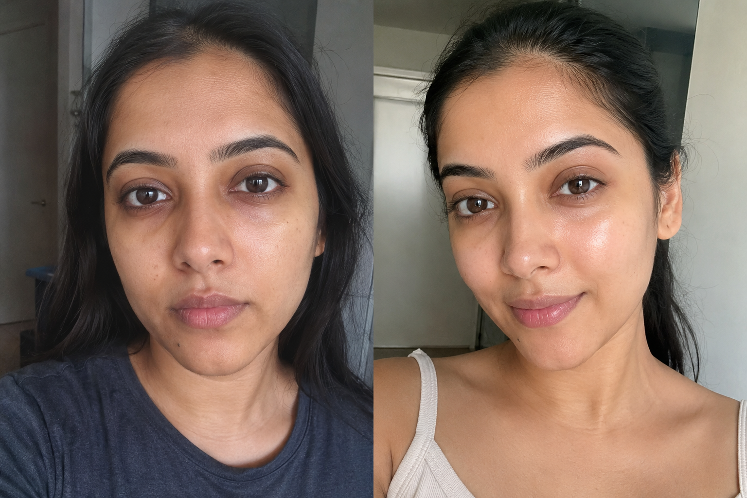 Sophie L. — before and after