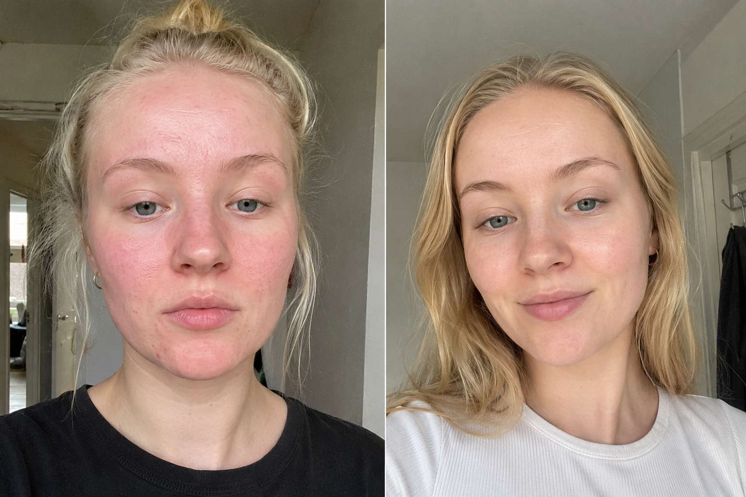 Juliette M. — before and after