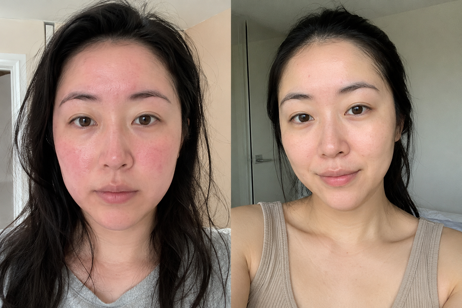 Elin S. — before and after