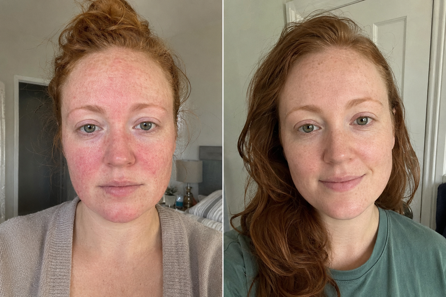Théa R. — before and after