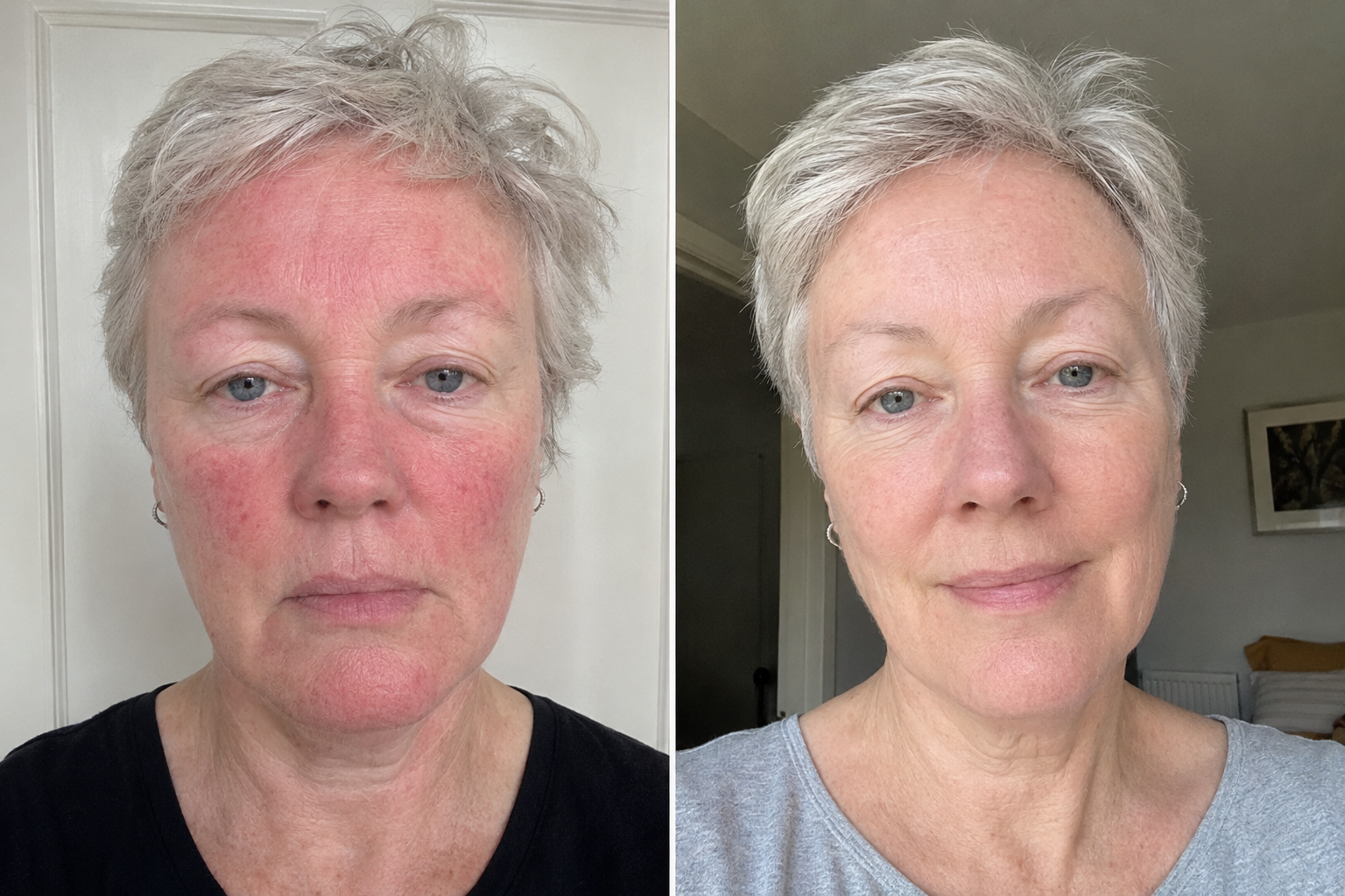 MOSSA Prebiotic Jelly Serum — before and after