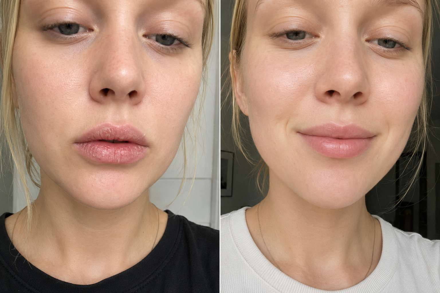Camille R. — before and after
