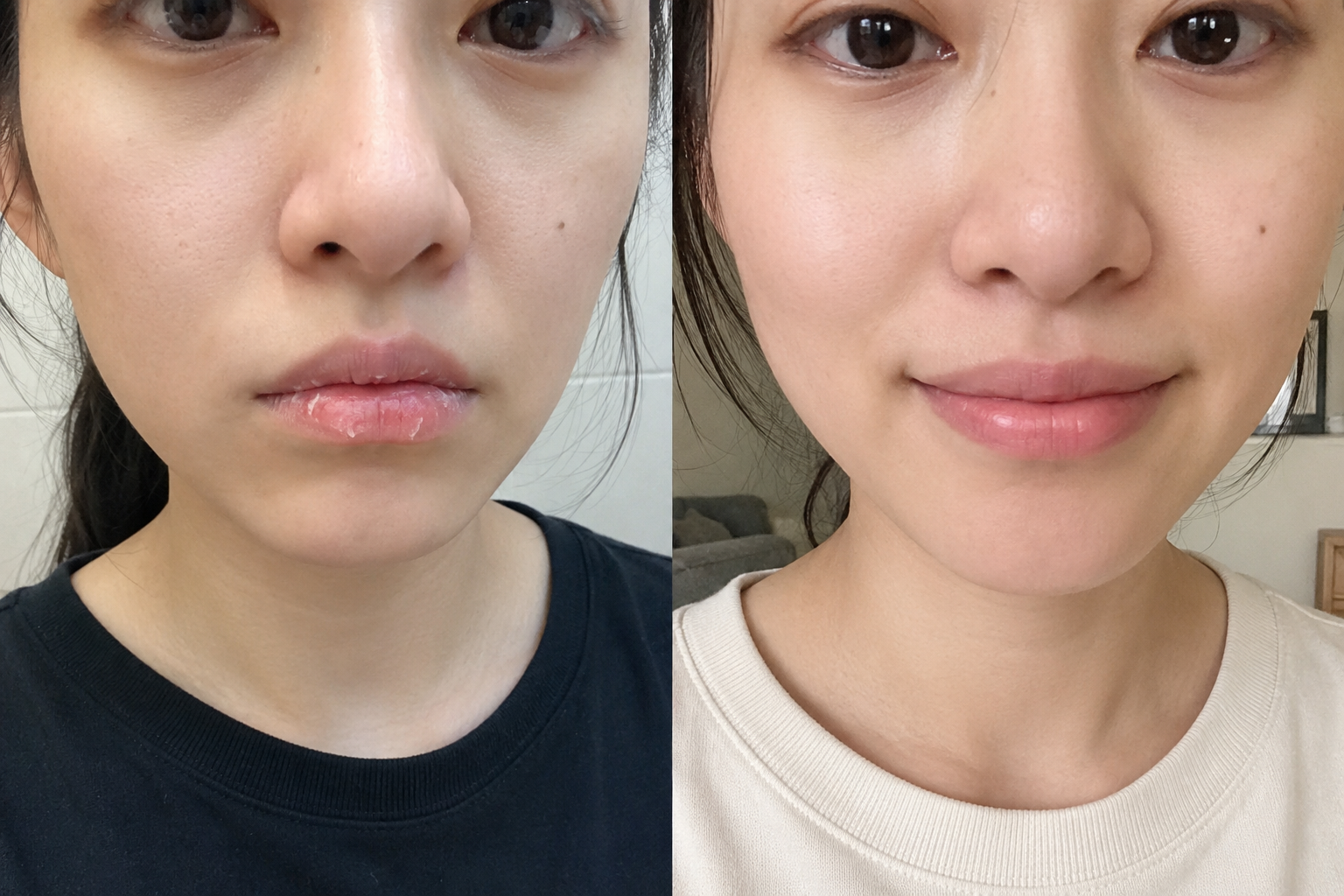 Léonie M. — before and after