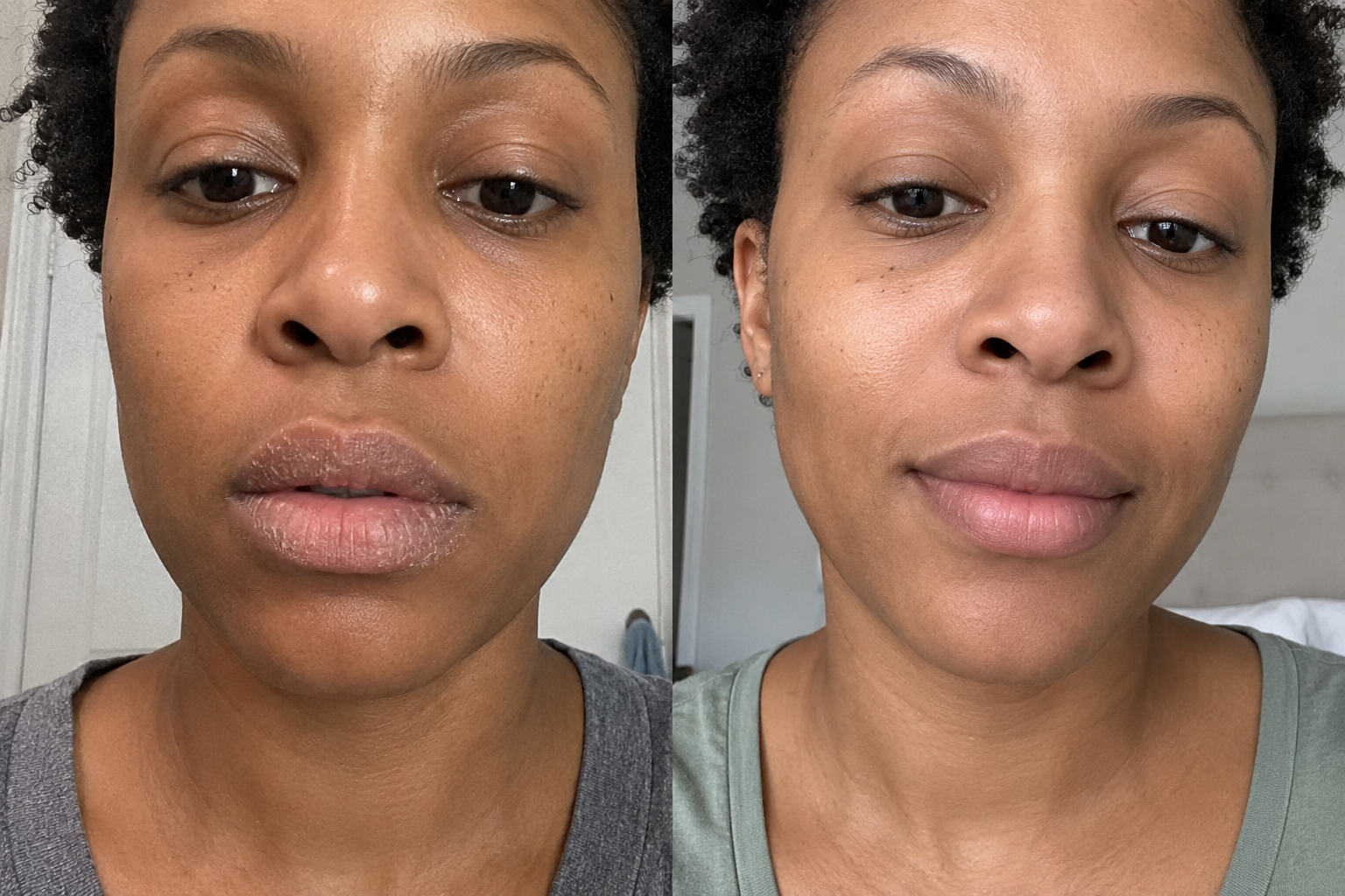 Hélène B. — before and after