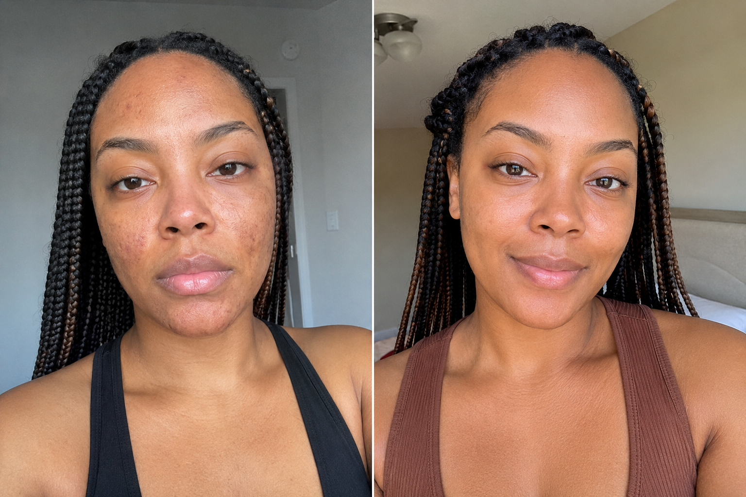Inès K. — before and after