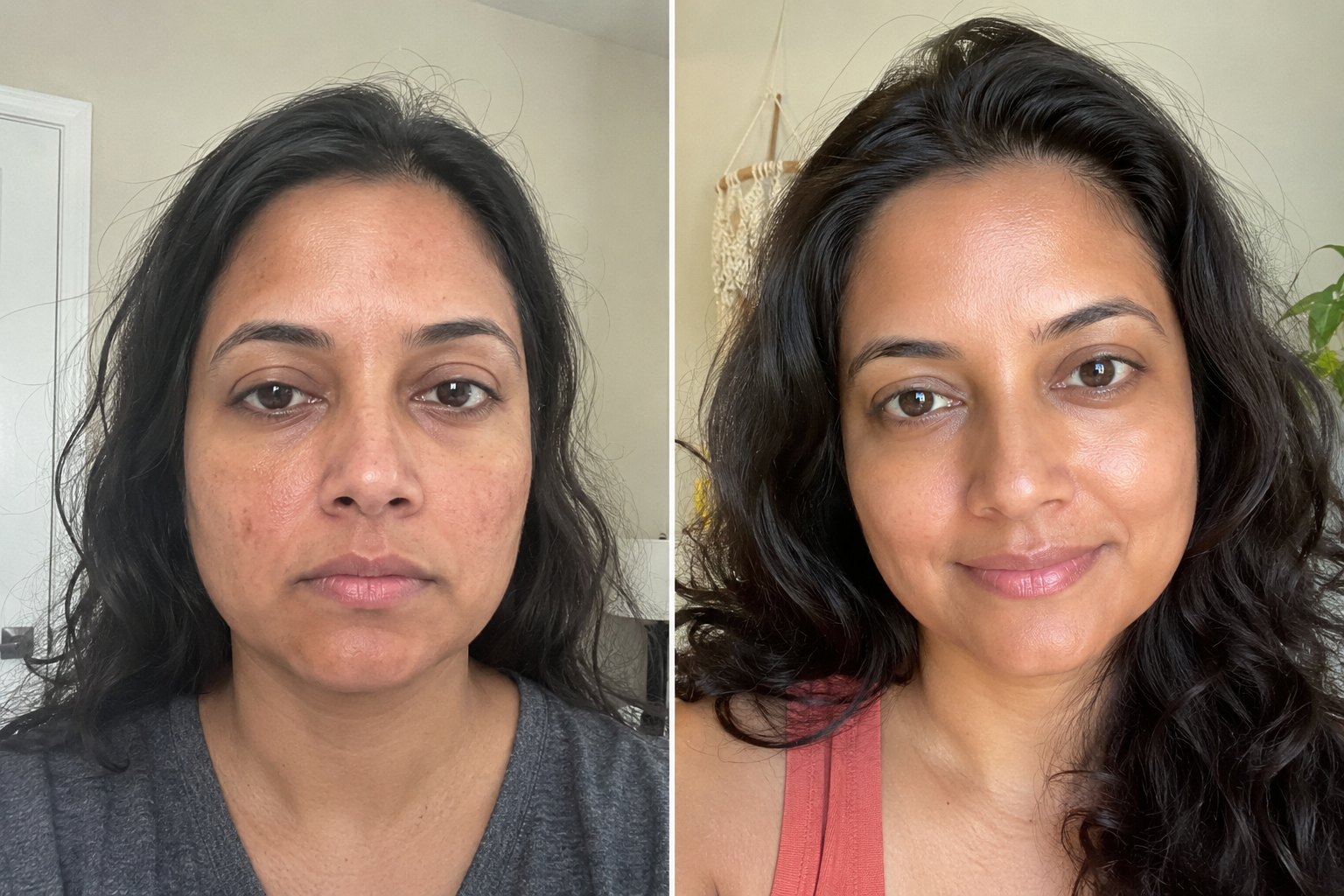 Clara V. — before and after