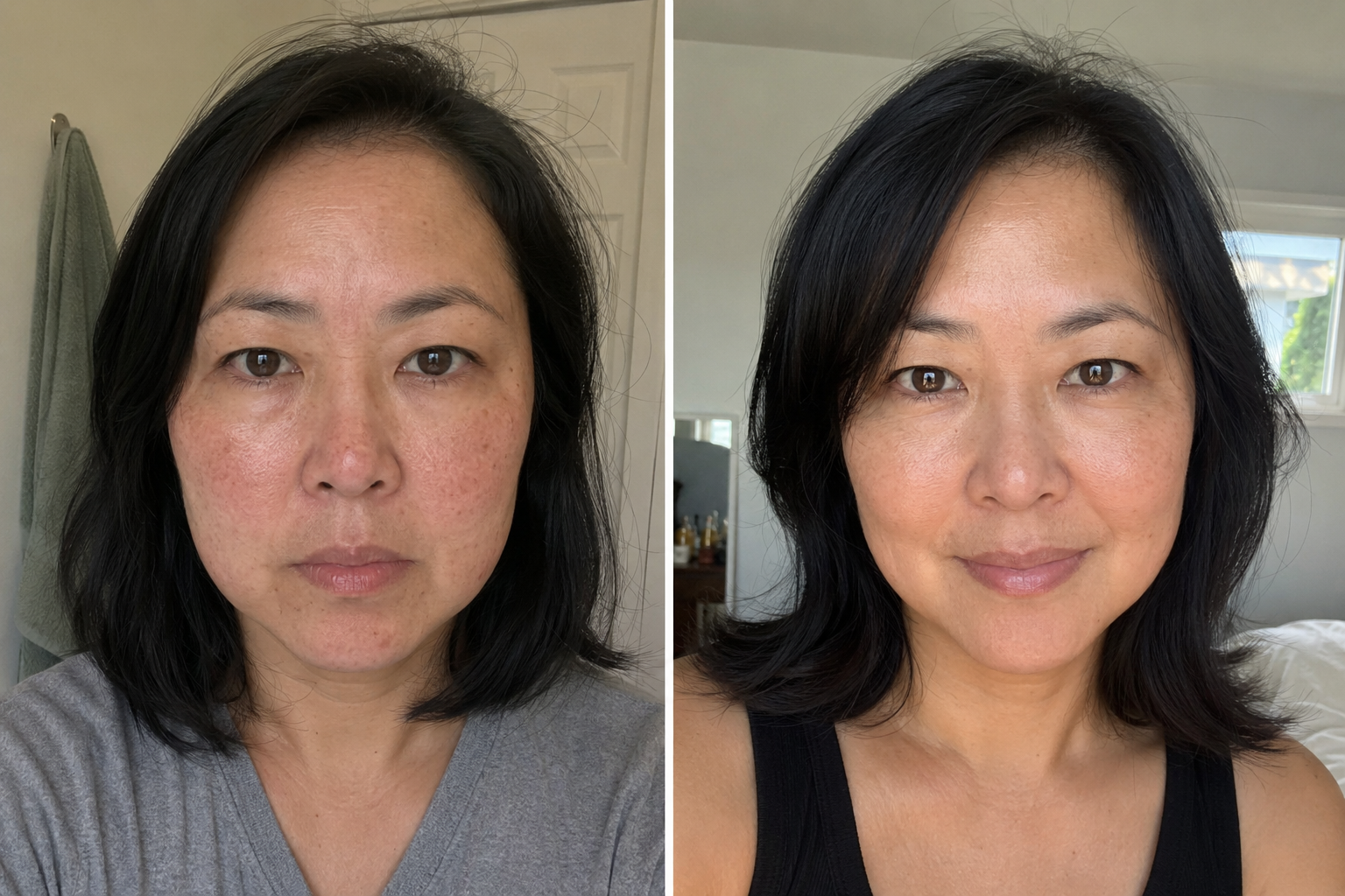 Sophie D. — before and after
